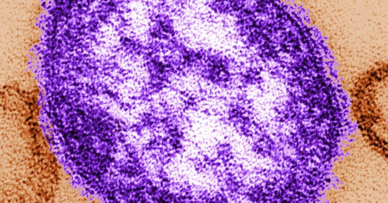 Measles case reported at LAX, Orange County children's hospital